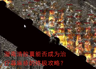 湿毒清胶囊能否成为治疗荨麻疹的终极攻略? 湿毒清胶囊能否成为治疗荨麻疹的终极攻略?