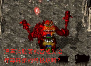 湿毒清胶囊能否成为治疗荨麻疹的终极攻略? 湿毒清胶囊能否成为治疗荨麻疹的终极攻略?